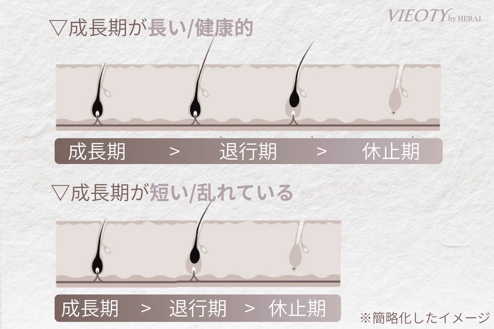 50代女性の抜け毛・薄毛の原因であるヘアサイクルの乱れを示す図解。加齢により「成長期」が短縮し、髪が十分に育つ前に抜けてしまうメカニズムを解説。