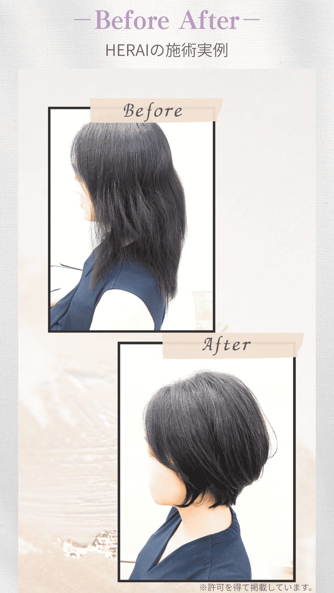 うねりと広がりが悩み